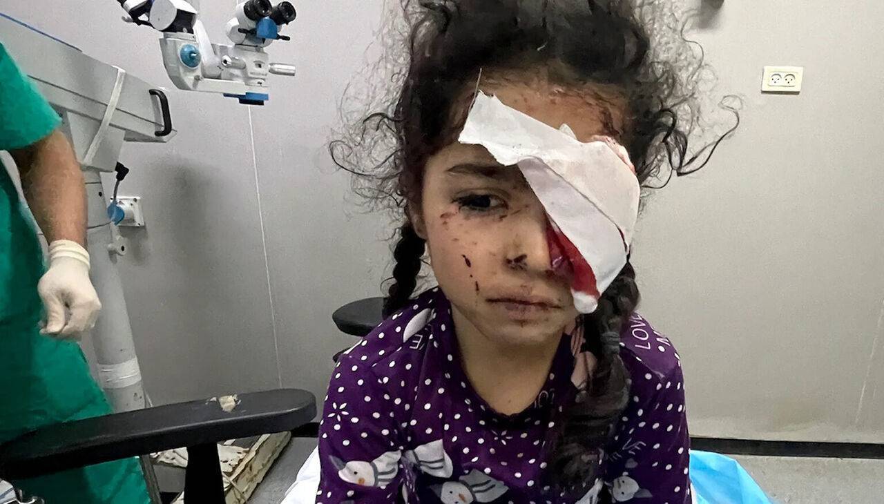 جنگ غزه بینایی ۱۵۰۰ فلسطینی را گرفت